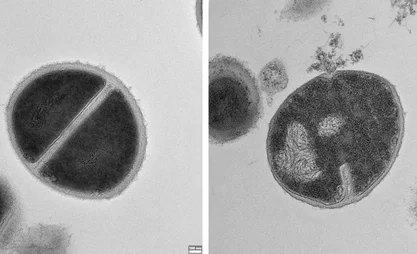 1a3dc8b0-fa02-11ef-8253-81408cbb565c.jpg.webp