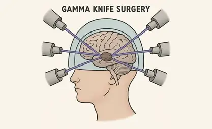 Gamma knife delivered to Kyrgyzstan for patient treatment