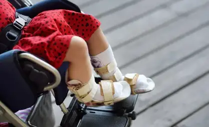 40 children in Kyrgyzstan suffer from SMA
